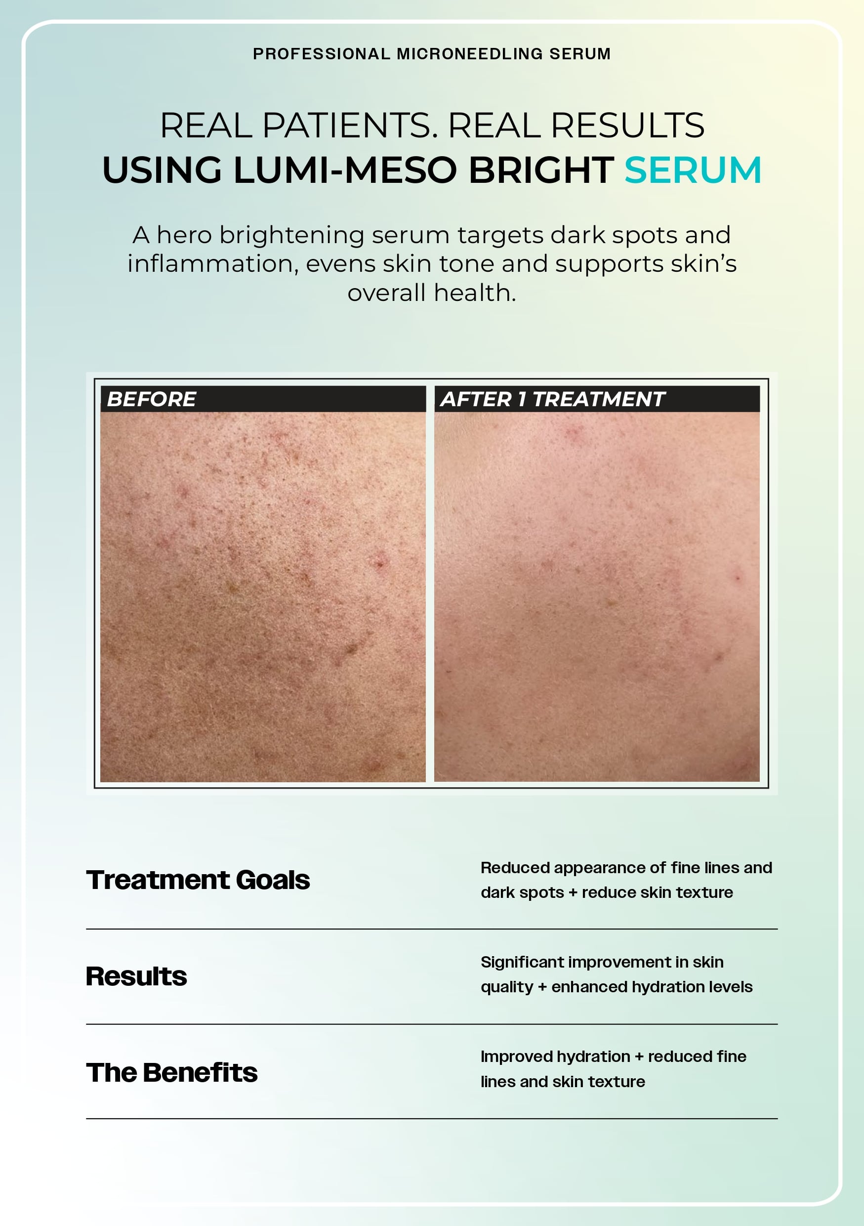 Brochure Page 6
