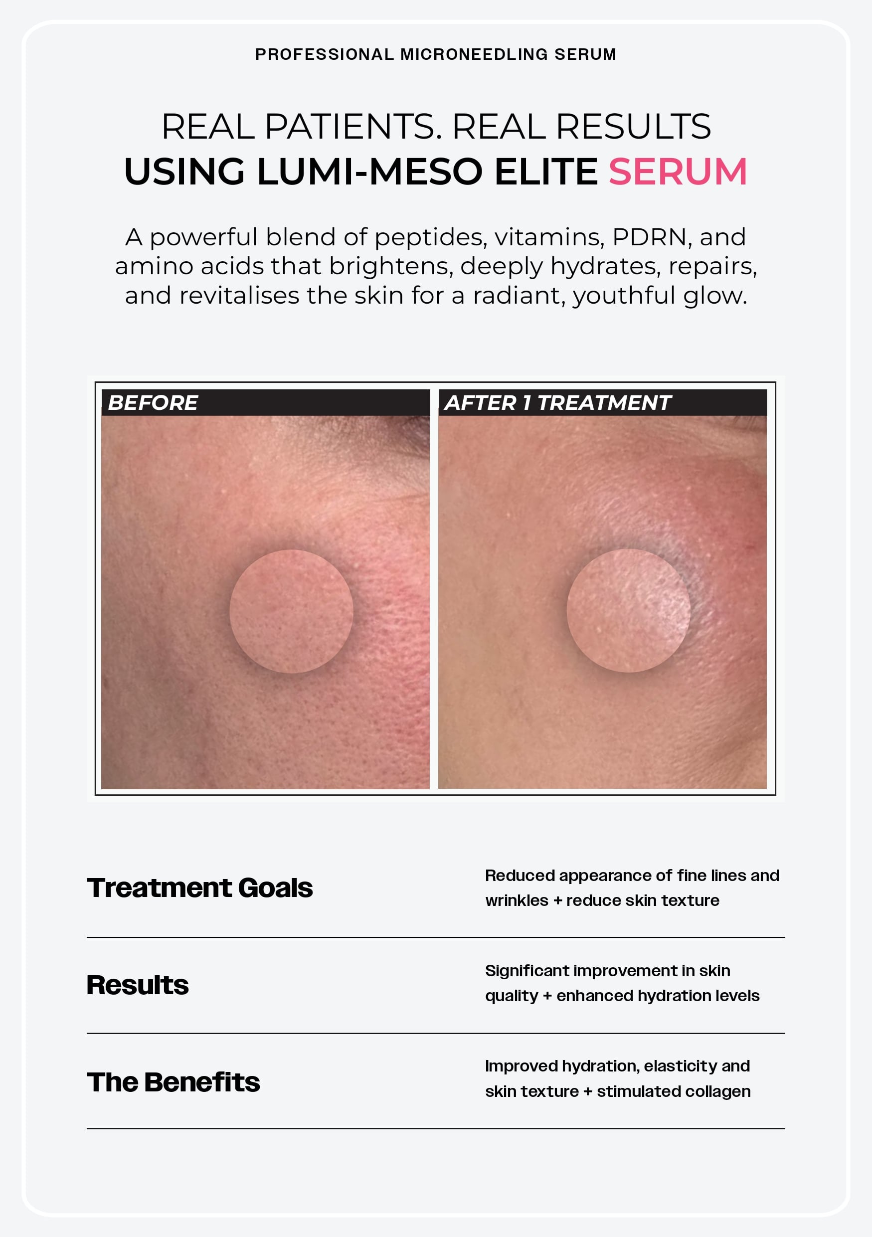 Brochure Page 6